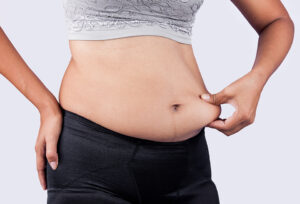 woman pinching belly fat